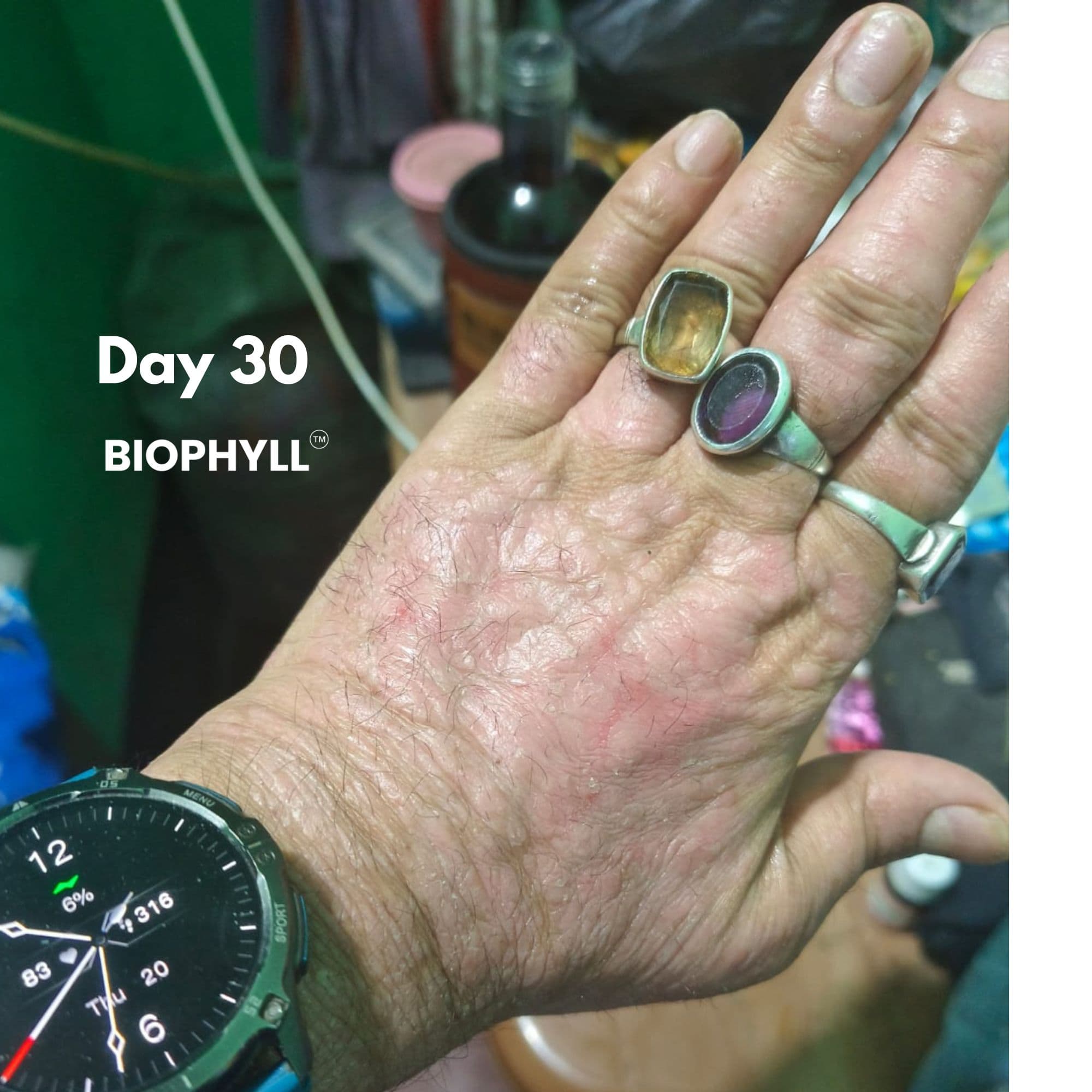 Rajesh Kulkarni After - Biophyll Chlorophyllin real customer detox result
