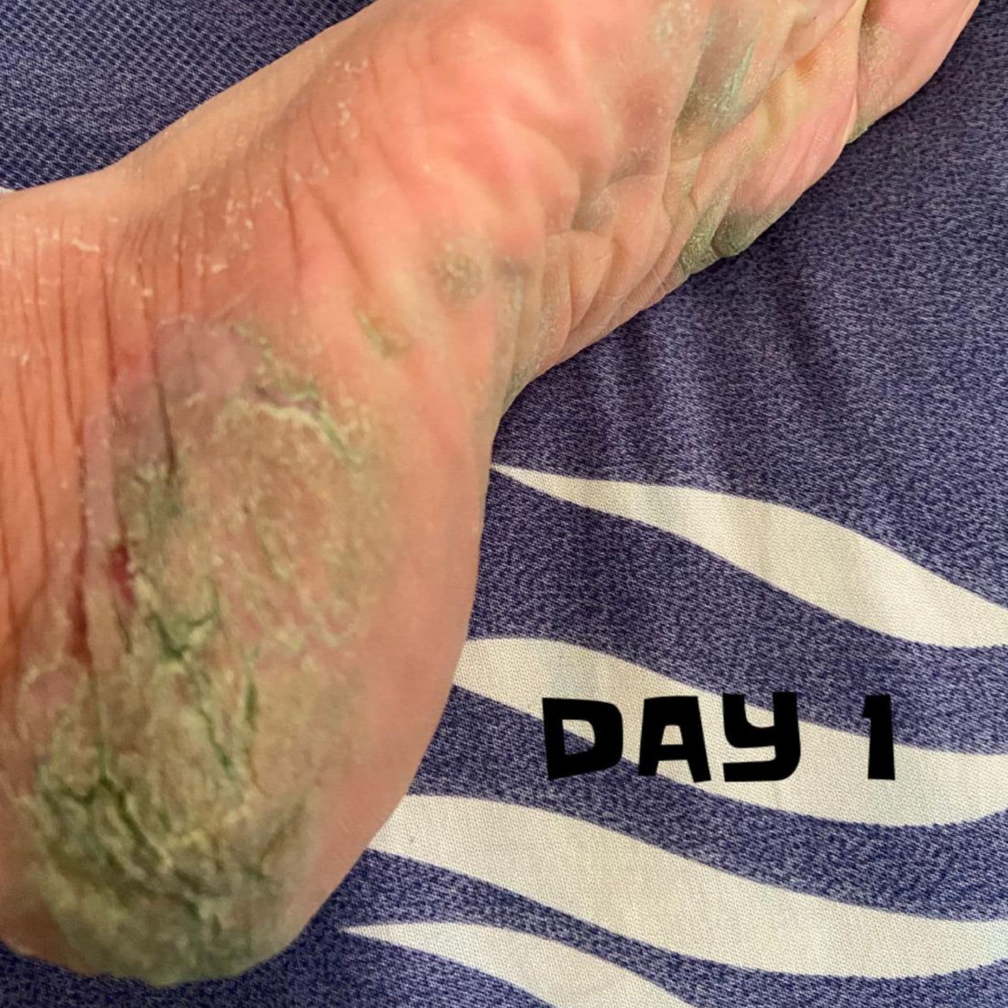 Ownmor Biophyll Chlorophyllin real customer detox result