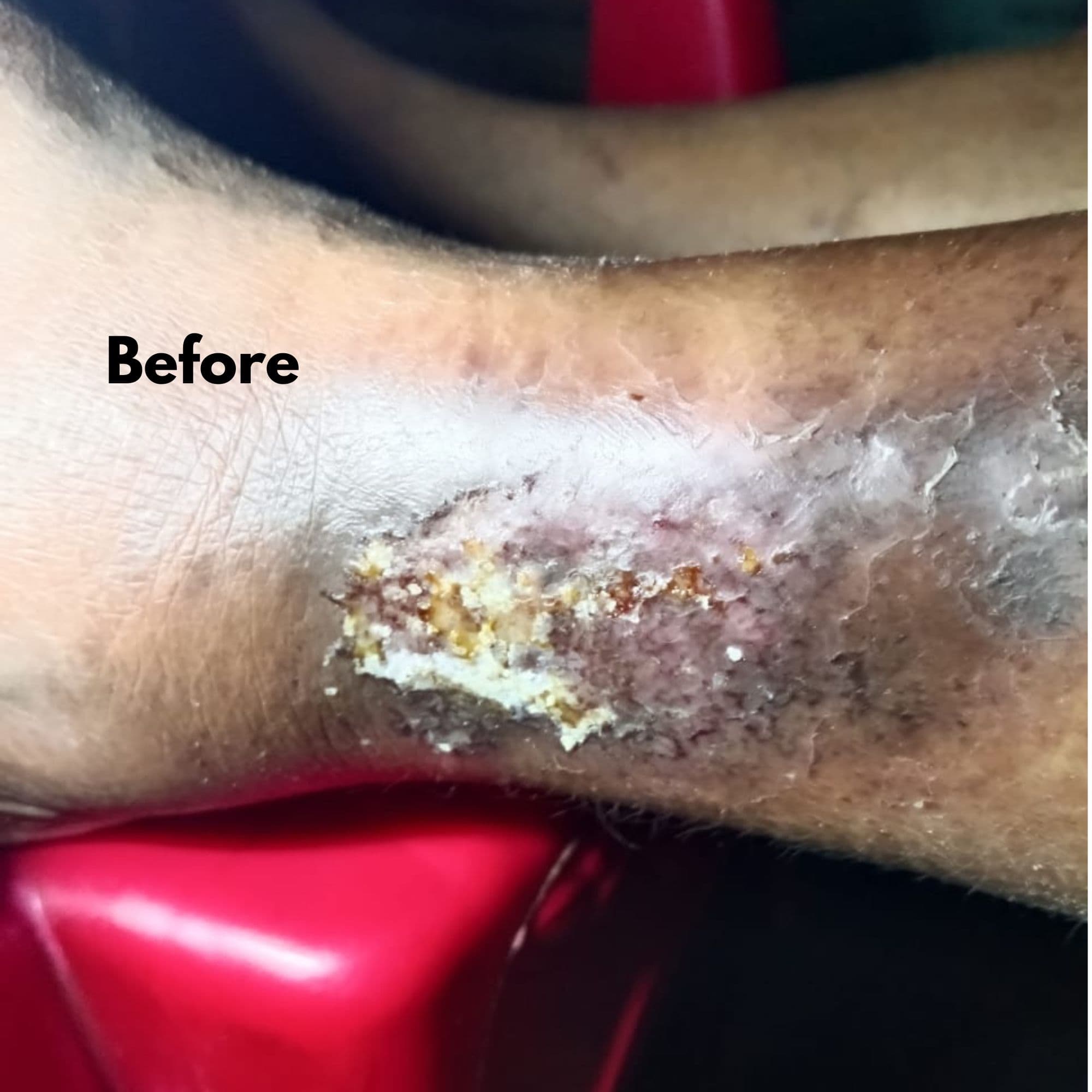 Ownmor Biophyll Chlorophyllin real customer detox result