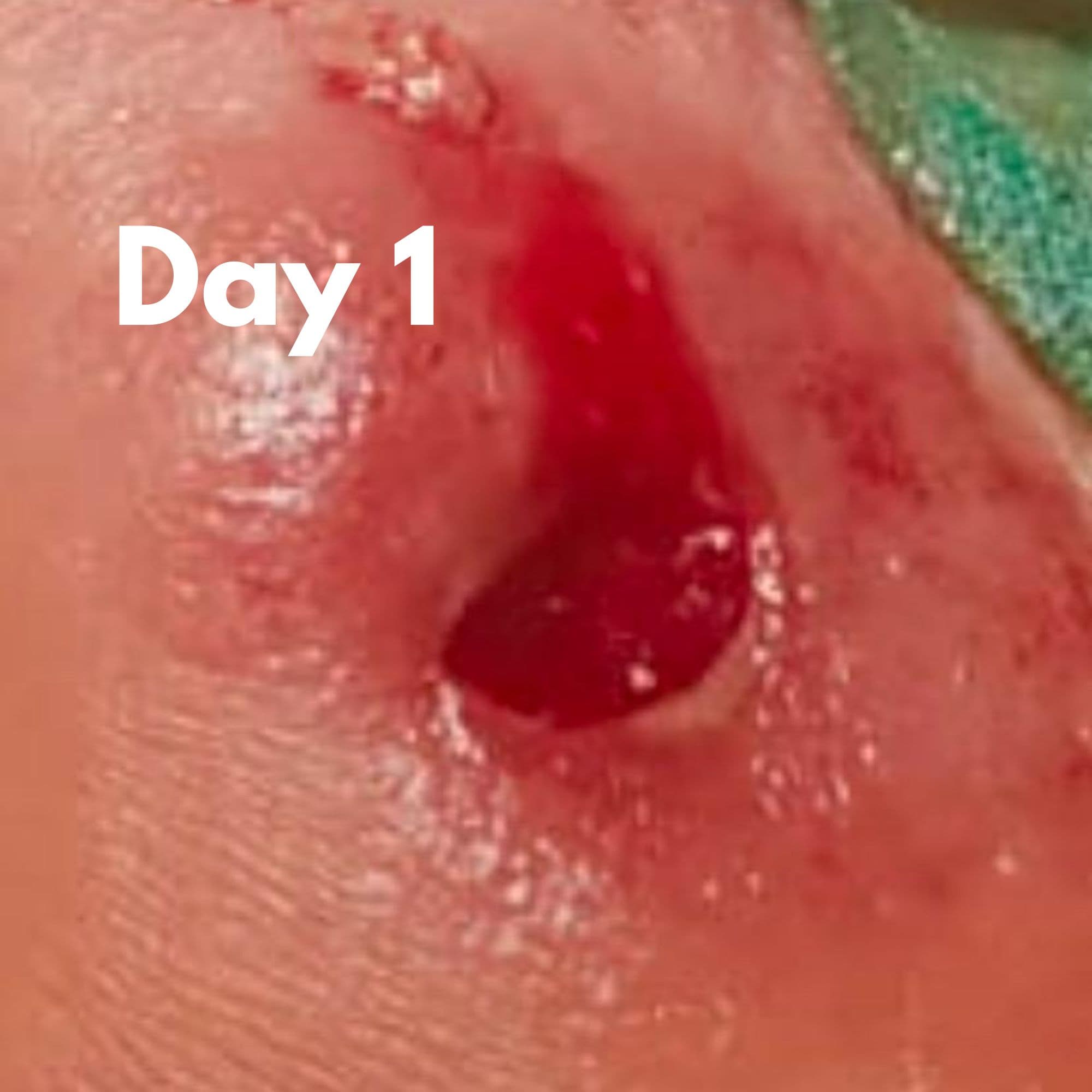 Deepak Verma Before - Biophyll Chlorophyllin real customer detox result