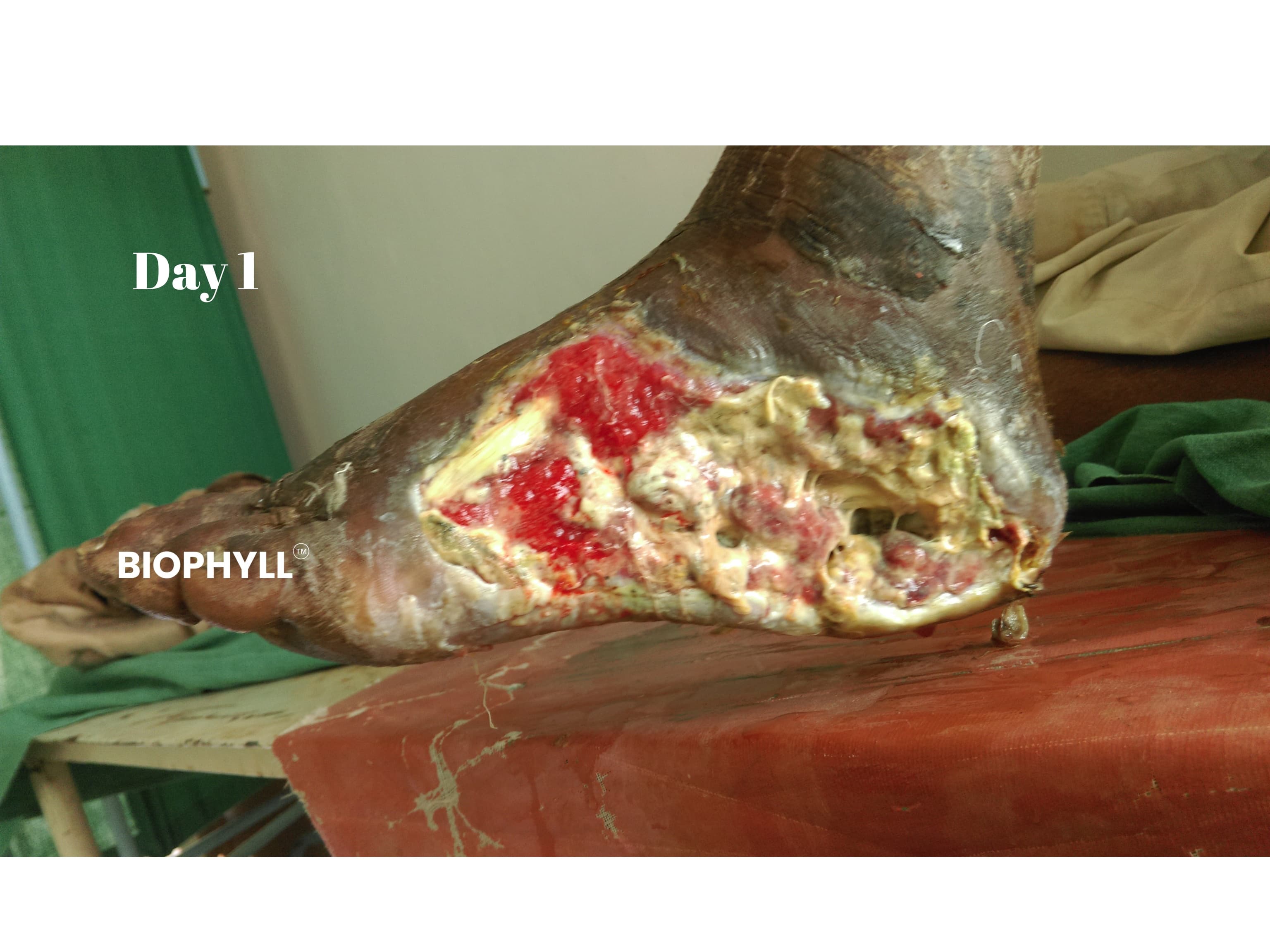 Ownmor Biophyll Chlorophyllin real customer detox result