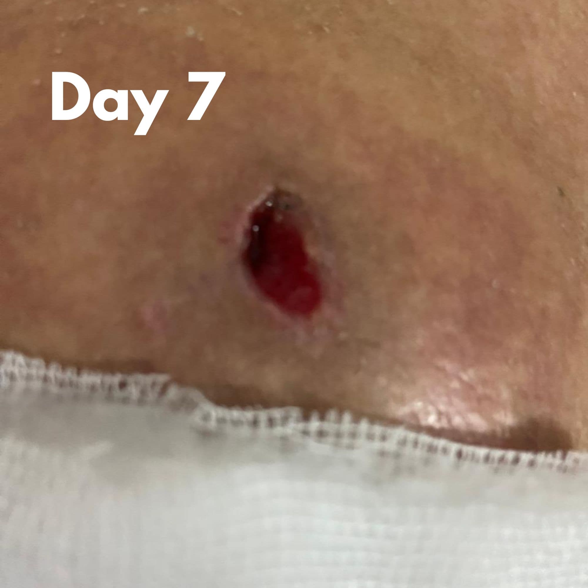 Deepak Verma After - Biophyll Chlorophyllin real customer detox result